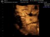 ai43.photobucket.com_albums_e386_GTP187_thumbsup.jpg