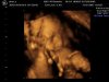 ai43.photobucket.com_albums_e386_GTP187_peace.jpg
